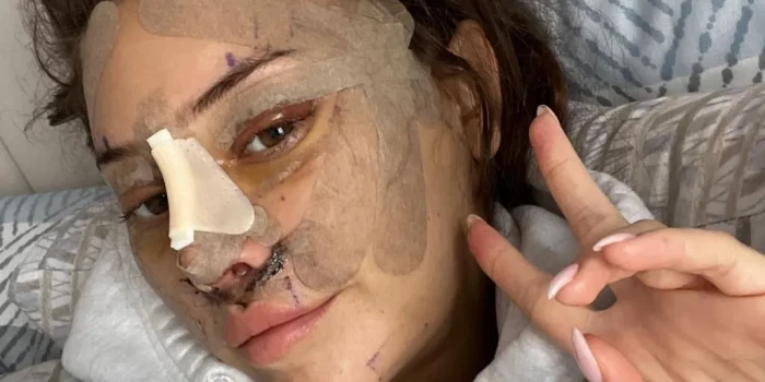 Դեմքի ձգում 28 տարեկանում․ ինչու՞ են երիտասարդները դիմում պլ...