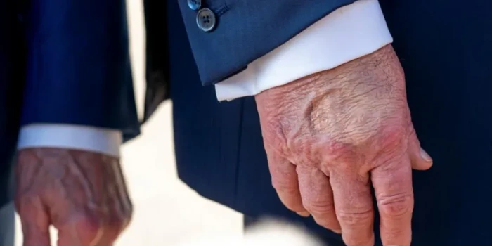 ԻՆՉ Է ԹՐԱՄՊԻ ՎԵՆԱՅԻ ՀԻՄՆԱՏԵՍՈՒԹՅՈՒՆԸ ԵՎ ՈՐՔԱԱՆ ԳԱՎՈՒՇԱԿԱՆ Է...