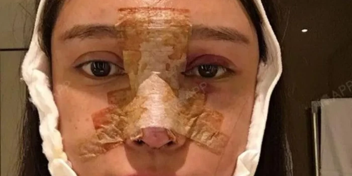 «Անցել եմ 100 վիրահատություն և չեմ պատրաստվում դադարեցնել»....