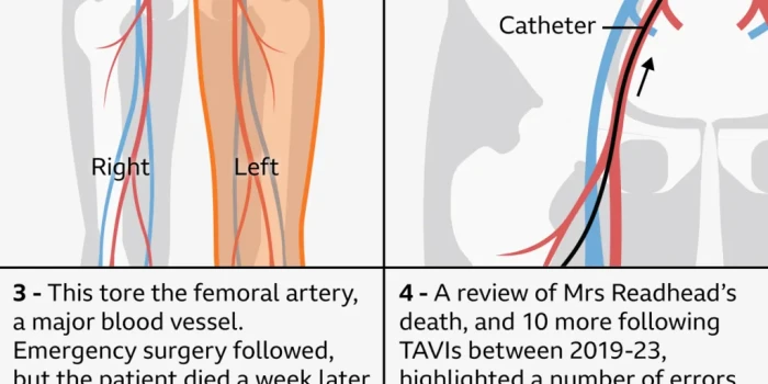 ՈՍԿԻ ՍԿԱՆԴԱԼԱՅԻՆ ՏԵՍԱԿԱՅԻՆ ՀԱՐՑԵՐ ՆԵՐԿԱՅԱՑՈՒՑ ԿԱՐԴԻՈԼՈԳԻԱՅԻ...