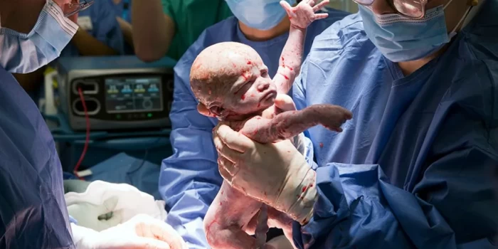 «Մի փոքր հրաշք»՝ Մեծ Բրիտանիայում առաջին երեխան, որը ծնվել է...