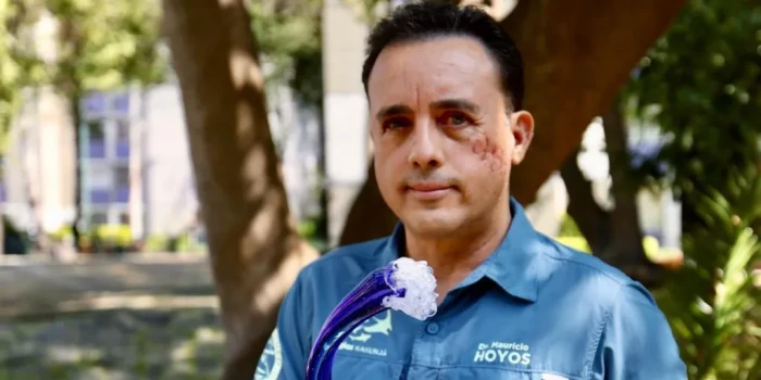 «Այդ կենդանին խնայեց կյանքս». Գալապագոսյան շնաողիից գլխից կծ...