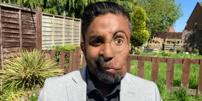 «Սրճարանում ինձ սպասարկելուց հրաժարվեցին միայն իմ դեմքի պատճ...