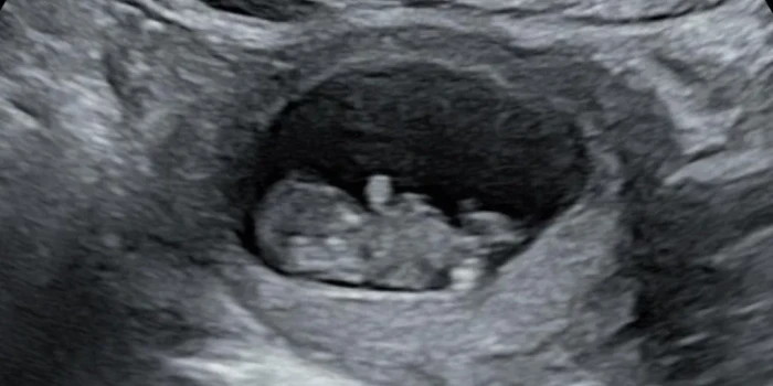 ՄԵԹԱՆ ՎԻՃԱՐԵԼՈՒ ՎԱՐԺԱՆՔ՝ ԿԱՆԱՆՑ ՀԵՏԻՆՔԻՑ ՀԵՏՈ